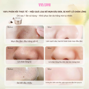 Kem Tẩy Tế Bào Chết VILUMI 3